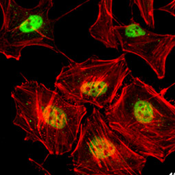 Rad50 antibody [13B3] (GTX70228)